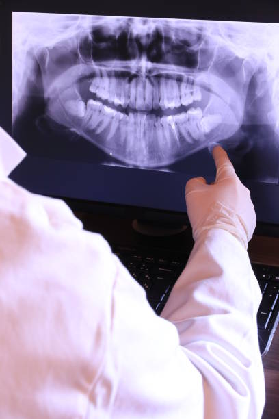 Best Emergency Broken Tooth Repair in Eagle Mountain, UT