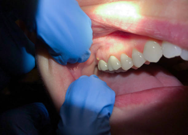 Best Weekend Emergency Dentist in Eagle Mountain, UT