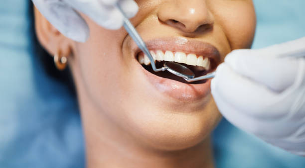 Best Emergency Dental Surgery in Eagle Mountain, UT