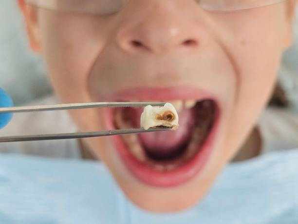 Best Weekend Emergency Dentist in Eagle Mountain, UT
