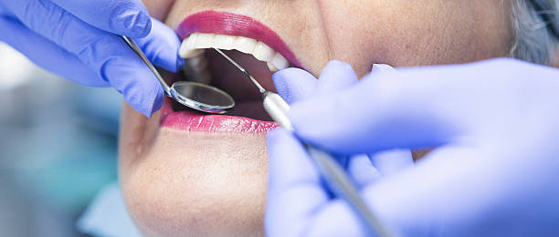 Best Walk-In Emergency Dentist in Eagle Mountain, UT